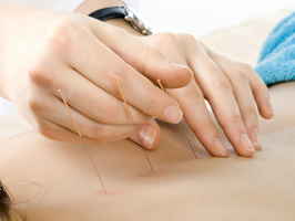 Profitable Acupuncture Practice located in N. Palm