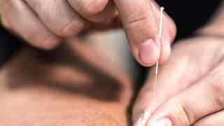 SBA Pre-Approved Profitable Acupuncture Practice