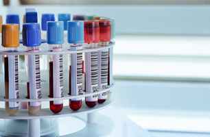 Clinical Laboratory Testing Services Franchise